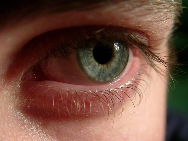מדוע העיניים אדומות וכיצד למנוע אי-נוחות?